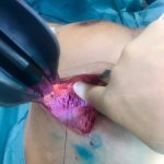 https://breastspecialist.co.uk/wp-content/uploads/2018/01/1-150x150.jpg